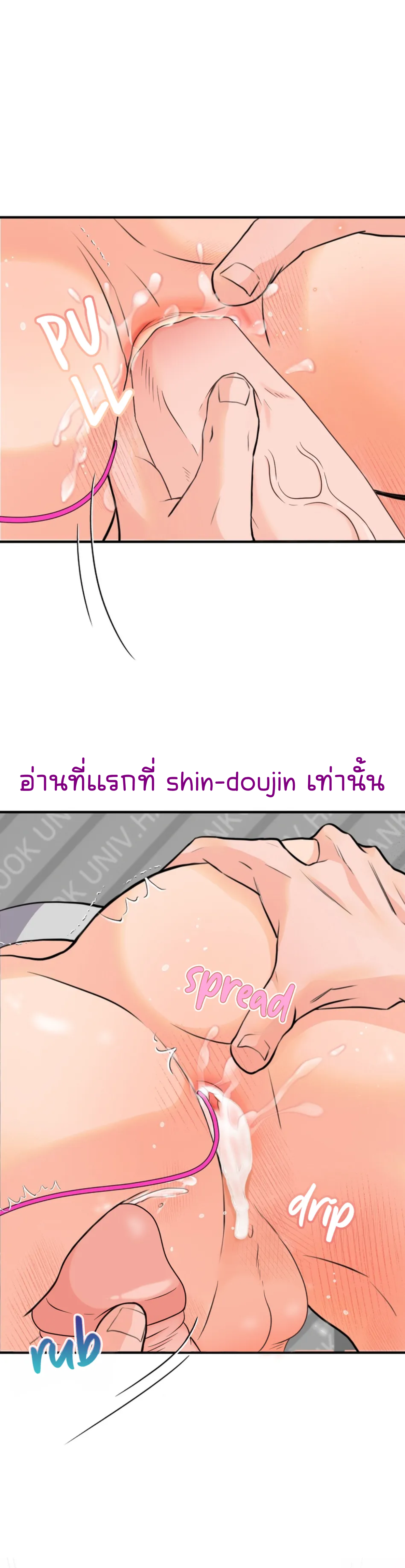 Prostate Capture Report EP 4